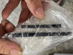 Месецима га је ужасно болела глава, онда су му у носу пронашли штапиће за јело