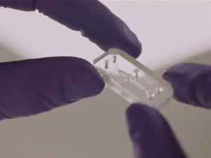 Како сићушни чип даје информације о стању наших црева