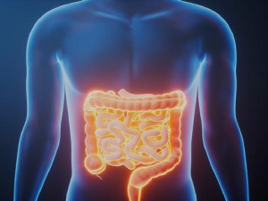 Узорци тумора стари више од једног века могли би да открију узроке повећања броја рака црева код младих 