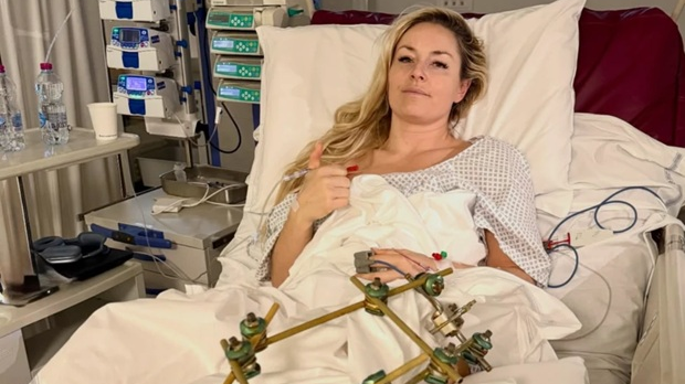 Линдси Вон трећи пут оперисана у Тревизу: Знам да ћу бити добро