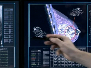 Иновативни лекови компаније Астра Зенека за пацијенте у Србији