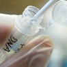 Генска терапија против ХИВ-а делује?