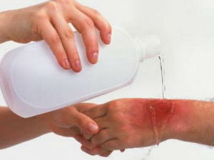 У средишту пажње