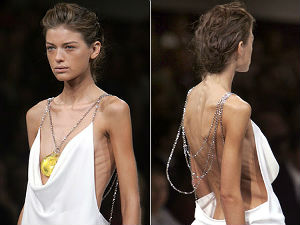 Француска: Казна за анорексичне манекенке до 75.000 евра?