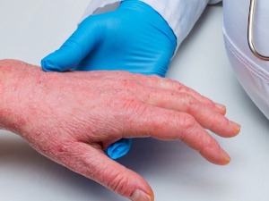 Дијабетес је све распрострањенији и међу младима - да ли би требало да се вакцинишу