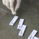 Крагујевац, тужилаштво проверава нестанак серолошких тестова