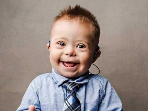 Ту сам - Даунов синдром, суочавање