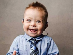 Ту сам - Даунов синдром, суочавање