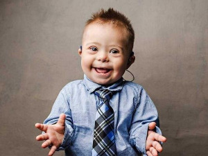 Ту сам - Даунов синдром, суочавање