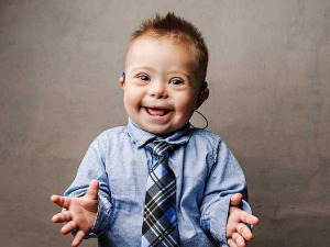 Ту сам - Даунов синдром, суочавање