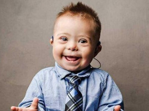 Ту сам - Даунов синдром, суочење