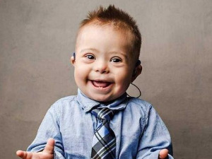 Ту сам - Даунов синдром, суочење