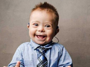 Ту сам - Даунов синдром, суочење