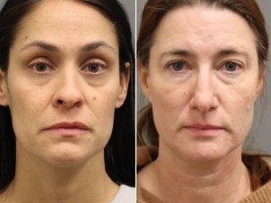 Медицинске сестре у САД ухапшене због продаје лажних потврда о вакцинацији