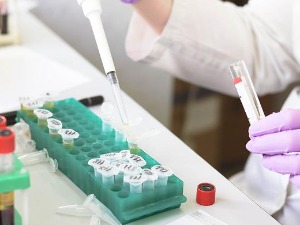 СЗО: Мистериозно обољење јетре код деце однело најмање један живот