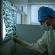Велики пробој британских научника у лечењу Алцхајмерове болести