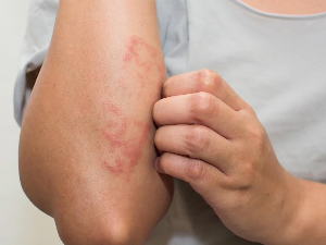 Шуга није ствар прошлости – треба мислити о томе када кренемо у кабину да пробамо неки комад одеће