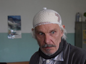 Делиријум тременс, 1-4