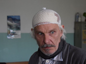 Делиријум тременс, 1-4