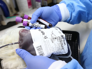 „Златна крв“: Зашто је Rh нулта крв најтраженија и како научници покушавају да је клонирају у лабораторији 