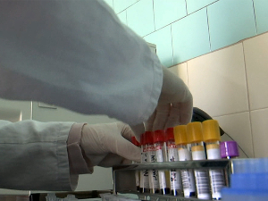 Губа стигла у регион, епидемиолози: У Србији нема разлога за забринутост