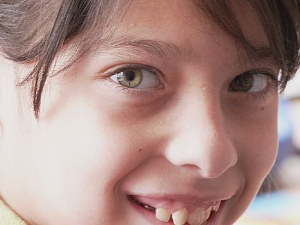 Инклузија: Ово је наша прича