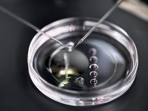 Да ли полигенски скрининг ембриона омогућава родитељима да имају паметнију и здравију децу