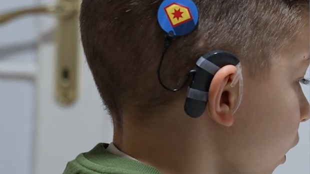 Ми можемо све – Међународни дан кохлеарног импланта