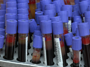 Смањене резерве крви, неке групе на минимуму