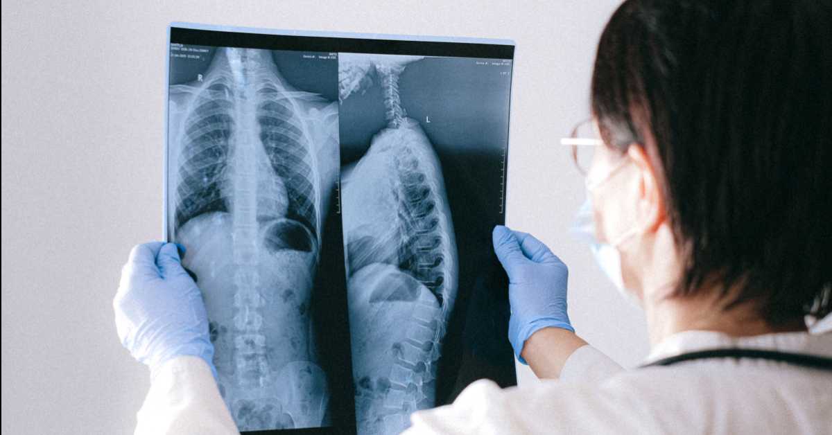 „Мислио сам да је то крај, а данас живим нормалним животом" – искуство пацијента који се лечи од рака плућа