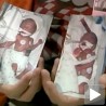 Близанци рођени у различитим годинама