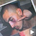 Употреба (не)прекомерне силе 