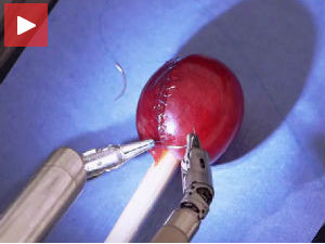 Робот ушива као најумешнији хирург