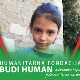 Магдалена због тумора на мозгу има и до 30 напада дневно, помозимо јој да оде у Хјустон