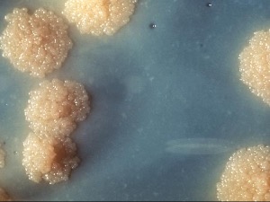 Сто година од бесеже вакцине