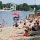 Шта је прво што треба да урадите када изгорите на сунцу