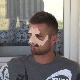 Претучени младић из Новог Брда после операције пуштен из болнице