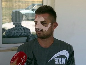 Претучени младић из Новог Брда: Нисам препознао нападаче, пао сам одмах