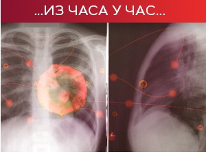 Борбу са ковидом изгубило још 9 људи, нових 2.314 случајева заразе