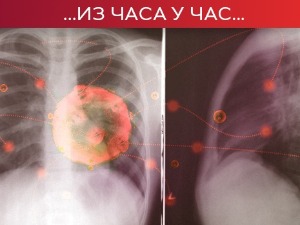 Преминуло још 27 особа, нови 5.461 случај заразе – Кризни штаб: Без нових мера, али пооштрене контроле