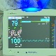 Један донор спасао три живота – више од 2.000 пацијената чека на трансплантацију