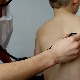 У чему се разликују епидемија хепатитиса у Загребу и мистериозно обољење јетре код деце