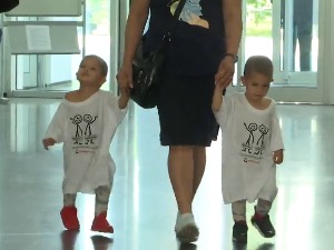 Разјашњење повезаности близанаца – када и како се ДНК може променити