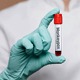 У Хрватској потврђен први случај мајмунских богиња