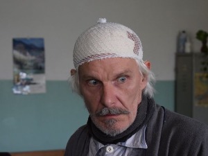 Делиријум тременс, 2-4